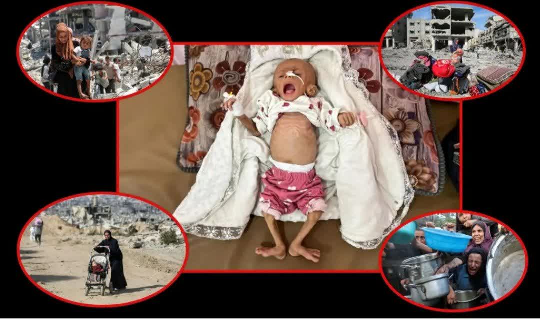 شهادت و جراحت ۱۹۸ هزار فلسطینی از سال گذشته تاکنون/قحطی بیداد می‌کند، کودکان در برابر دوربین‌ها می‌میرند